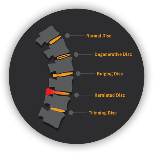 b1-back-pain-spine-graphic.png b1-back-pain-spine-graphic.png